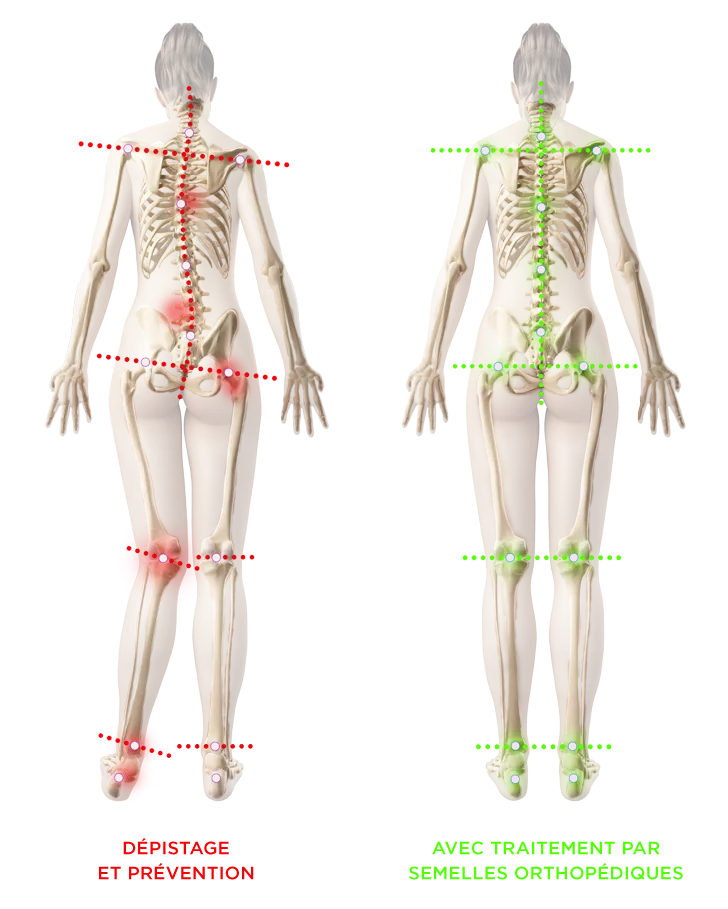 Podologue du sport analysant la posture d'un patient