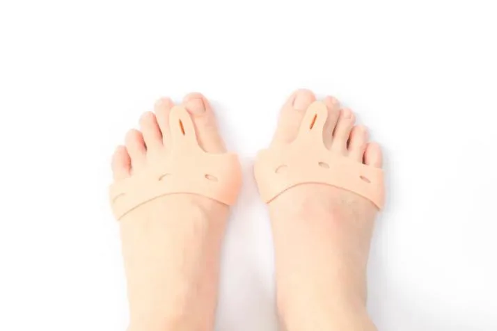 Pied présentant un hallux valgus